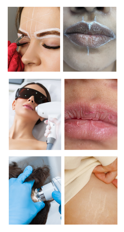Cosmetic Treatment -Genesis Micropigmentation and Dental Treatment