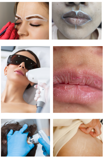 Genesis Micropigmentation and Dental Treatment
